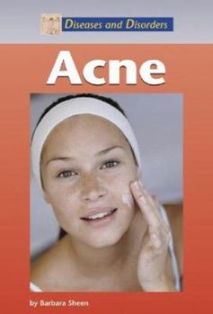 Hardcover Acne (Diseases and Disorders) Book
