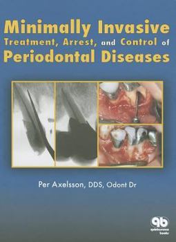 Hardcover Minimally Invasive Treatment, Arrest and Control of Periodontal Diseases Book
