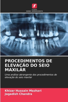 Paperback Procedimentos de Elevação Do Seio Maxilar [Portuguese] Book