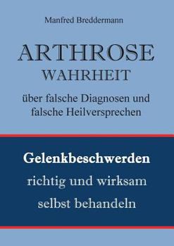 Arthrose: Gelenkbeschwerden richtig und wirksam behandeln