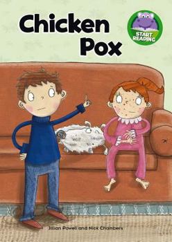 Paperback Chicken Pox (Start Reading) Book
