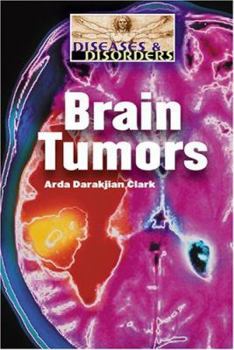 Library Binding Brain Tumors Book