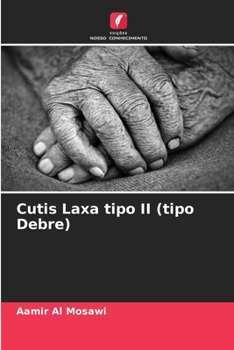 Cutis Laxa tipo II (tipo Debre) (Portuguese Edition)