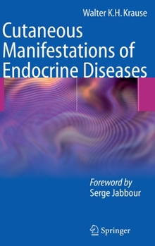 Hardcover Cutaneous Manifestations of Endocrine Diseases Book