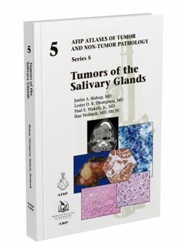 Hardcover Tumors of the Salivary Glands: Series 5 Book