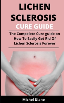 Paperback Lichen Sclerosis Cure Guide: The Complete Cure Guide On The Causes, Manifestations, Complexities, Drugs, Treatments And How To Easily Get Rid Of Lichen Sclerosis Forever Book