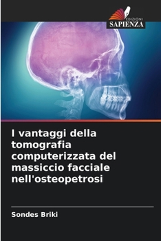 Paperback I vantaggi della tomografia computerizzata del massiccio facciale nell'osteopetrosi [Italian] Book