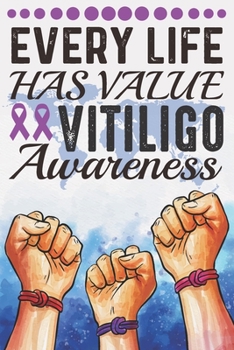 Every Life Has Value Vitiligo Awareness: College Ruled Vitiligo Awareness Journal, Diary, Notebook 6 x 9 inches with 100 Pages