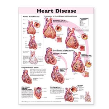 Poster Heart Disease Anatomical Chart Book