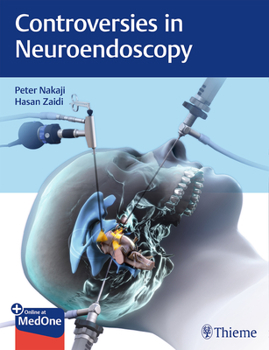 Hardcover Controversies in Neuroendoscopy Book