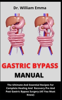 Paperback Gastric Bypass Manual: The Simple Recipes And Bariatric Cookbook On Diet For Gastric Bypass Book