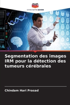 Paperback Segmentation des images IRM pour la détection des tumeurs cérébrales [French] Book