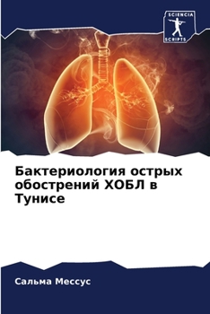 Paperback Бактериология острых об& [Russian] Book