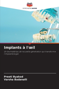Paperback Implants à l'oeil [French] Book