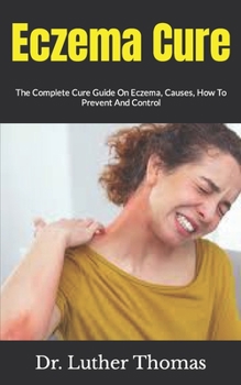 Paperback Eczema Cure: The Complete Cure Guide On Eczema, Causes, How To Prevent And Control Book