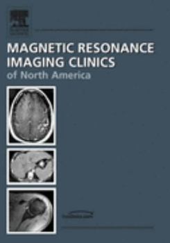 Hardcover Body MR Angiography, an Issue of Magnetic Resonance Imaging Clinics: Volume 13-1 Book