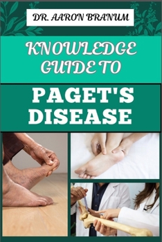 KNOWLEDGE GUIDE TO PAGET’S DISEASE: Essential Manual To Symptoms, Diagnosis, Treatment Options, and Long-term Management