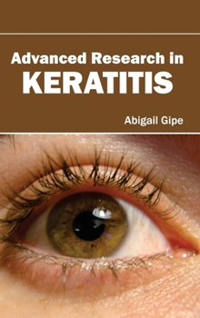 Hardcover Advanced Research in Keratitis Book