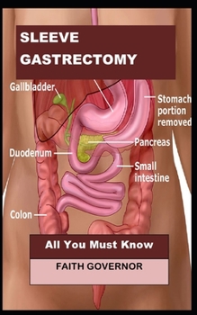 Paperback Sleeve Gastrectomy: All You Must Know Book