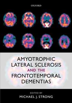 Hardcover Amyotrophic Lateral Sclerosis and the Frontotemporal Dementias Book