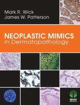 Hardcover Neoplastic Mimics in Dermatopathology Book