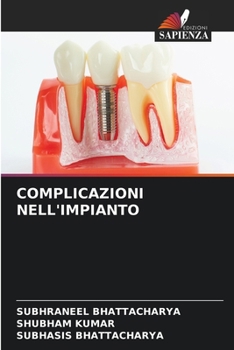 Paperback Complicazioni Nell'impianto [Italian] Book