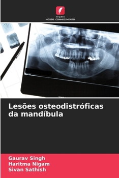Lesões osteodistróficas da mandíbula (Portuguese Edition)