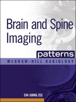 Hardcover Brain and Spine Imaging Patterns: Brain & Spine Imaging Book