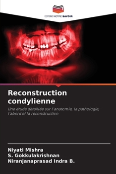 Paperback Reconstruction condylienne [French] Book