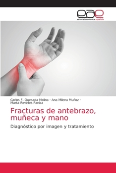 Paperback Fracturas de antebrazo, muñeca y mano [Spanish] Book