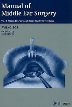 Hardcover Manual of Middle Ear Surgery: Mastoid Surgery and Reconstructive Procedures Book