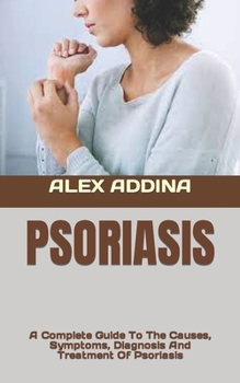Paperback Psoriasis: A Complete Guide To The Causes, Symptoms, Diagnosis And Treatment Of Psoriasis Book