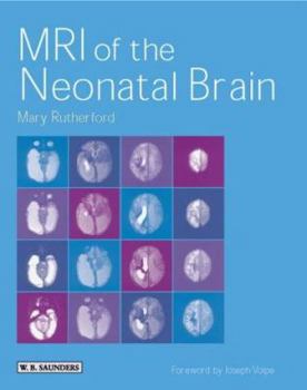 Hardcover MRI of the Neonatal Brain Book