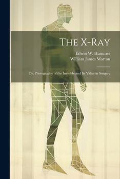 Paperback The X-Ray; Or, Photography of the Invisible and Its Value in Surgery Book