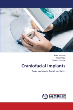 Paperback Craniofacial Implants Book