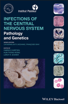 Hardcover Infections of the Central Nervous System Book