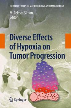 Paperback Diverse Effects of Hypoxia on Tumor Progression Book