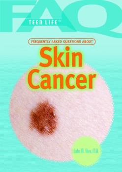 Library Binding Frequently Asked Questions about Skin Cancer Book