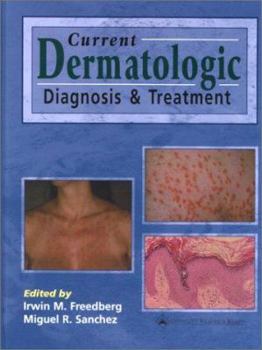 Hardcover Current Dermatologic Diagnosis and Treatment: Co-Published with Current Medicine Book