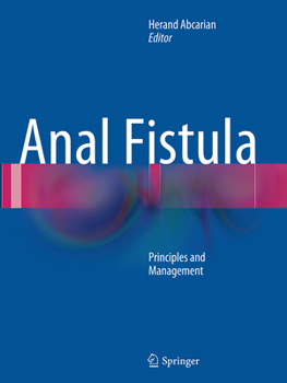Paperback Anal Fistula: Principles and Management Book