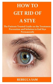 Paperback How to Get Rid of a Stye: The Patients Trusted Guide on the Treatment, Prevention and Solution to End Stye Permanently Book