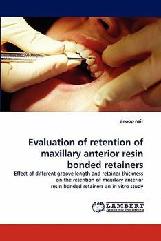 Paperback Evaluation of Retention of Maxillary Anterior Resin Bonded Retainers Book