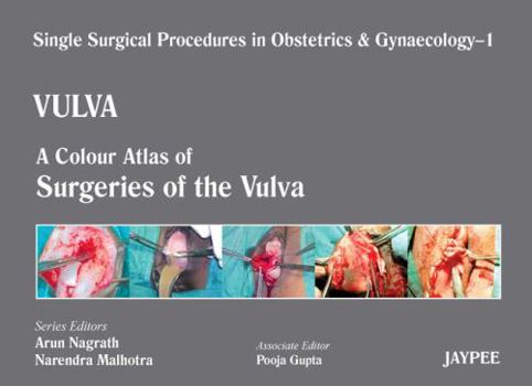 Single Surgical Procedures in Obstetrics and Gynaecology - Vulva: Volume 1: A Colour Atlas of Surgeries of the Vulva