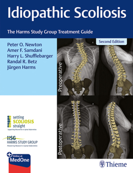 Hardcover Idiopathic Scoliosis: The Harms Study Group Treatment Guide Book