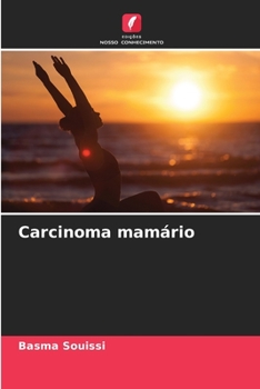 Paperback Carcinoma mamário [Portuguese] Book