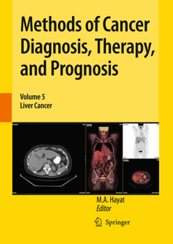 Paperback Methods of Cancer Diagnosis, Therapy, and Prognosis: Liver Cancer Book