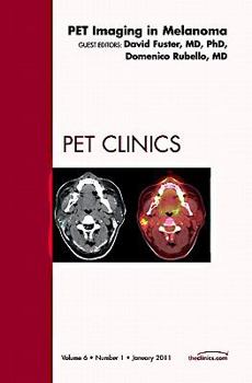 Hardcover Pet Imaging in Melanoma, an Issue of Pet Clinics: Volume 6-1 Book