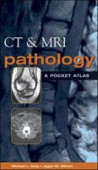 Paperback CT & MRI Pathology: A Pocket Atlas Book