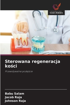 Paperback Sterowana regeneracja ko&#347;ci [Polish] Book