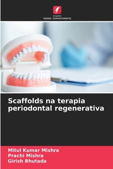 Paperback Scaffolds na terapia periodontal regenerativa [Portuguese] Book